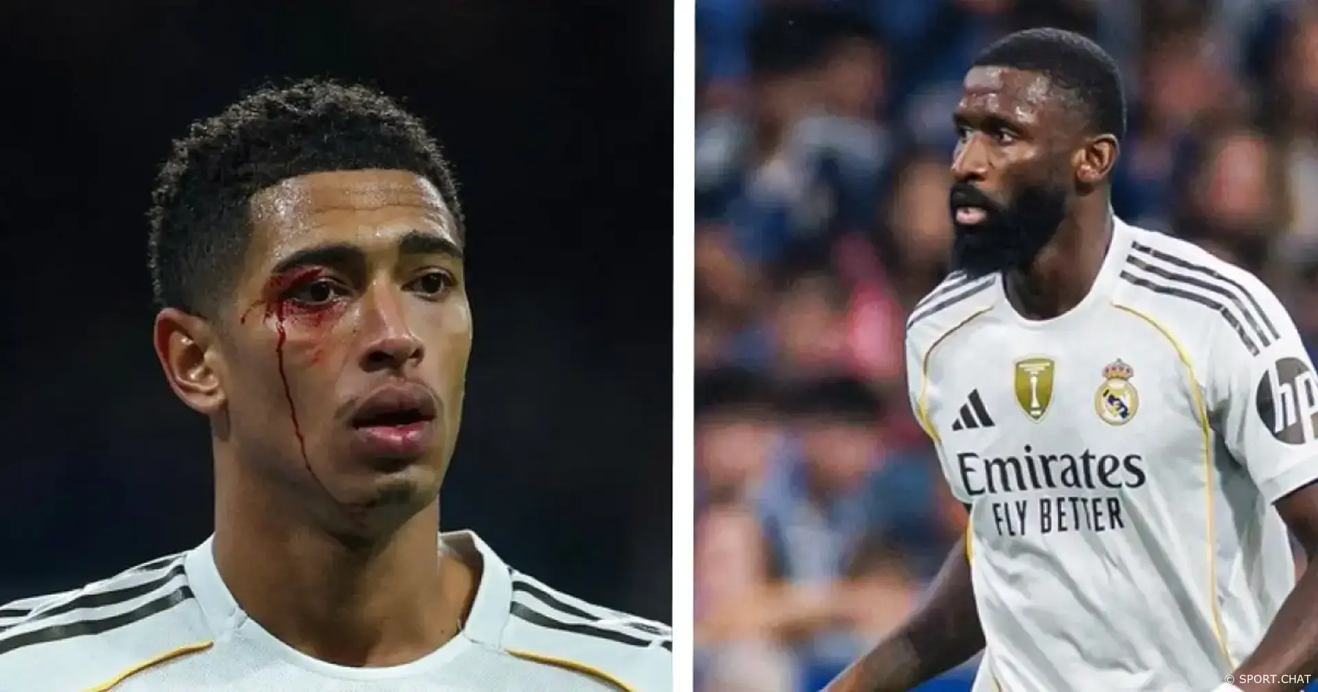 Беллингем, Вальверде и Рюдигер получили повреждения в матче с «Сельтой»